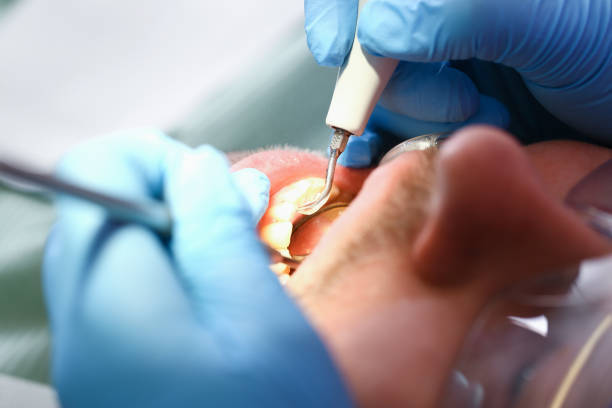 Best Walk-In Emergency Dental Services in Daleville, IN
