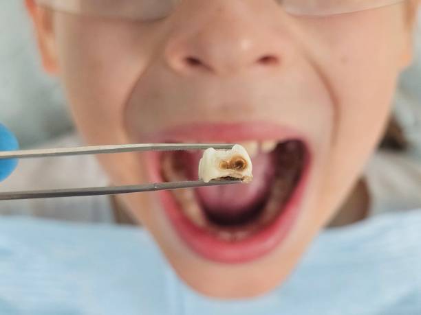 Best Emergency Orthodontic Repairs in Daleville, IN
